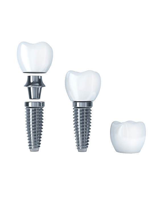 2.7.3_Dental_Abutments-and-Screws